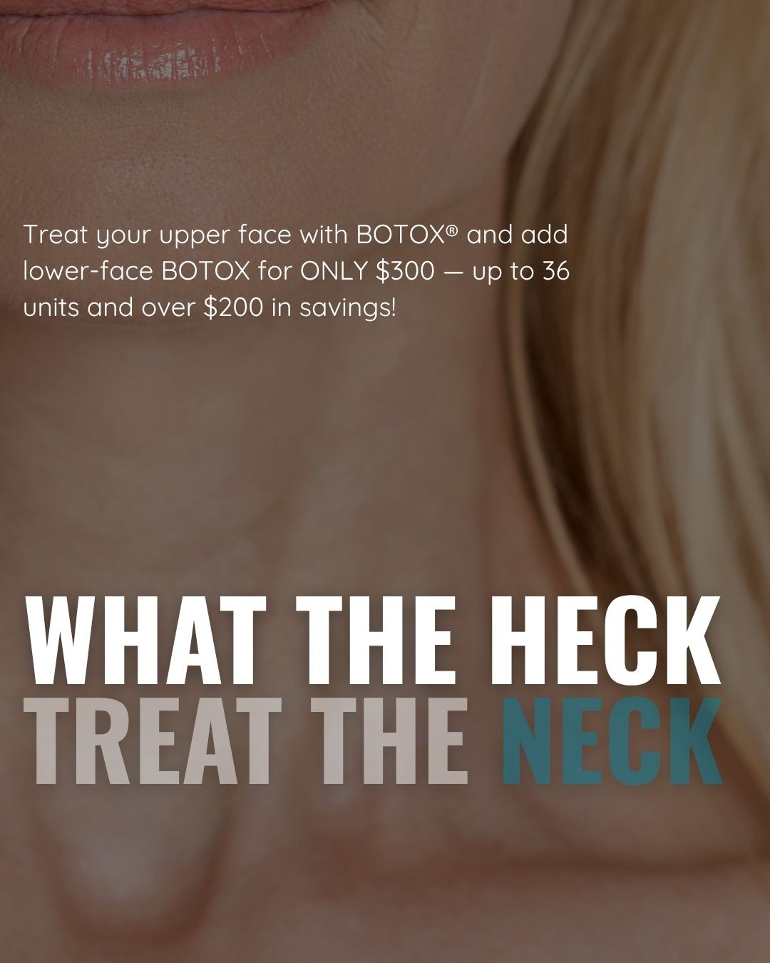 Botox Special